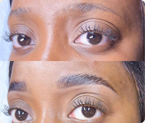 Avant et après brow lift