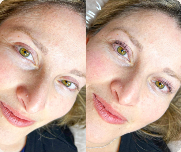 Avant et après rehaussement de cils